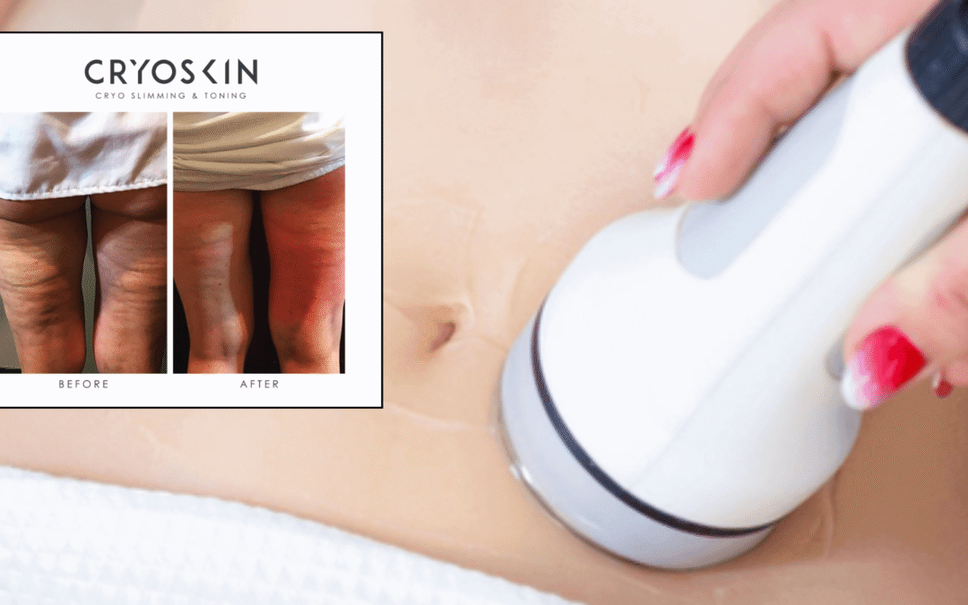 Exciting News: New Cavitation Pricing at The Body Shop Spa!